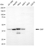 CNP Monoclonal Antibody (24GB8575)