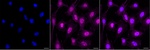 CK1 alpha Recombinant Rabbit Monoclonal Antibody (25GB125)