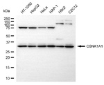 CK1 alpha Antibody in Western Blot (WB)