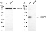 CK1 alpha Antibody in Western Blot (WB)