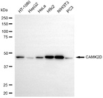 CaMKII delta Recombinant Rabbit Monoclonal Antibody (25GB605)