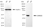 CaMKII delta Antibody in Western Blot (WB)