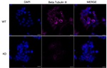 Beta III Tubulin Antibody in Immunocytochemistry (ICC/IF)