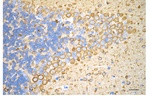 Beta III Tubulin Antibody in Immunohistochemistry (Paraffin) (IHC (P))