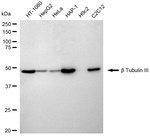 Beta III Tubulin Antibody in Western Blot (WB)
