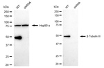 Beta III Tubulin Antibody in Western Blot (WB)