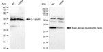 BDNF Antibody in Western Blot (WB)