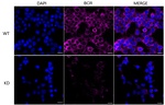 BCR Antibody in Immunocytochemistry (ICC/IF)
