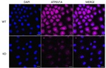 ATP6V1A Antibody in Immunocytochemistry (ICC/IF)