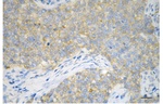 ATP6V1A Antibody in Immunohistochemistry (Paraffin) (IHC (P))