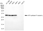 ATP Synthase gamma Antibody in Western Blot (WB)