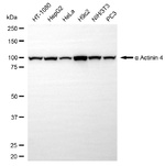alpha Actinin 4 Antibody in Western Blot (WB)
