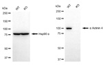 alpha Actinin 4 Antibody in Western Blot (WB)