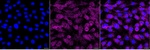AKT3 Monoclonal Antibody (25GB3675)