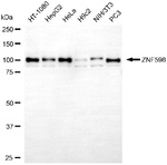ZNF598 Antibody in Western Blot (WB)