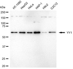 YY1 Monoclonal Antibody (24GB7020)