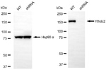 YTHDC2 Antibody in Western Blot (WB)