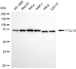TTLL12 Monoclonal Antibody (25GB5050)