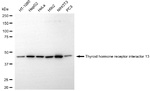 TRIP13 Antibody in Western Blot (WB)