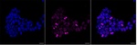 TPX2 Antibody in Immunocytochemistry (ICC/IF)
