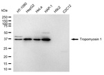 TPM1 Antibody in Western Blot (WB)