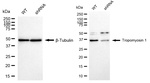 TPM1 Antibody in Western Blot (WB)