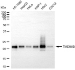 TMEM9B Antibody in Western Blot (WB)