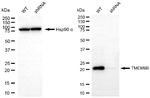 TMEM9B Antibody in Western Blot (WB)