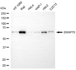 SWAP70 Monoclonal Antibody (25GB4225)