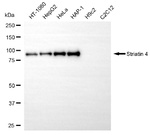 STRN4 Antibody in Western Blot (WB)