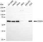 STK39 Antibody in Western Blot (WB)
