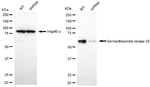 STK33 Antibody in Western Blot (WB)