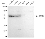 STAT6 Antibody in Western Blot (WB)