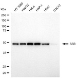 SSB Antibody in Western Blot (WB)