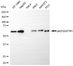 SQSTM1 Antibody in Western Blot (WB)