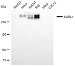 SORL1 Monoclonal Antibody (24GB13375)