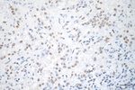 SNRPA1 Antibody in Immunohistochemistry (Paraffin) (IHC (P))