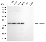 SIRT5 Antibody in Western Blot (WB)