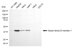 SERPINB1 Antibody in Western Blot (WB)