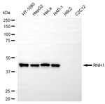 RNH1 Monoclonal Antibody (25GB5120)