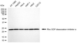RhoGDI Antibody in Western Blot (WB)