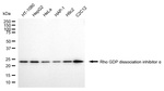 RhoGDI Antibody in Western Blot (WB)