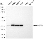 REEP2 Recombinant Rabbit Monoclonal Antibody (25GB4095)