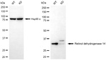 RDH14 Antibody in Western Blot (WB)