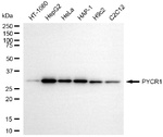 PYCR1 Antibody in Western Blot (WB)