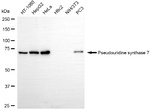PUS7 Antibody in Western Blot (WB)