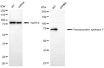 PUS7 Antibody in Western Blot (WB)