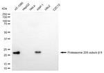 PSMB8 Monoclonal Antibody (24GB6765)