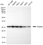 PSMA6 Antibody in Western Blot (WB)