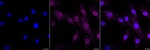Progesterone Receptor Recombinant Rabbit Monoclonal Antibody (25GB2650)